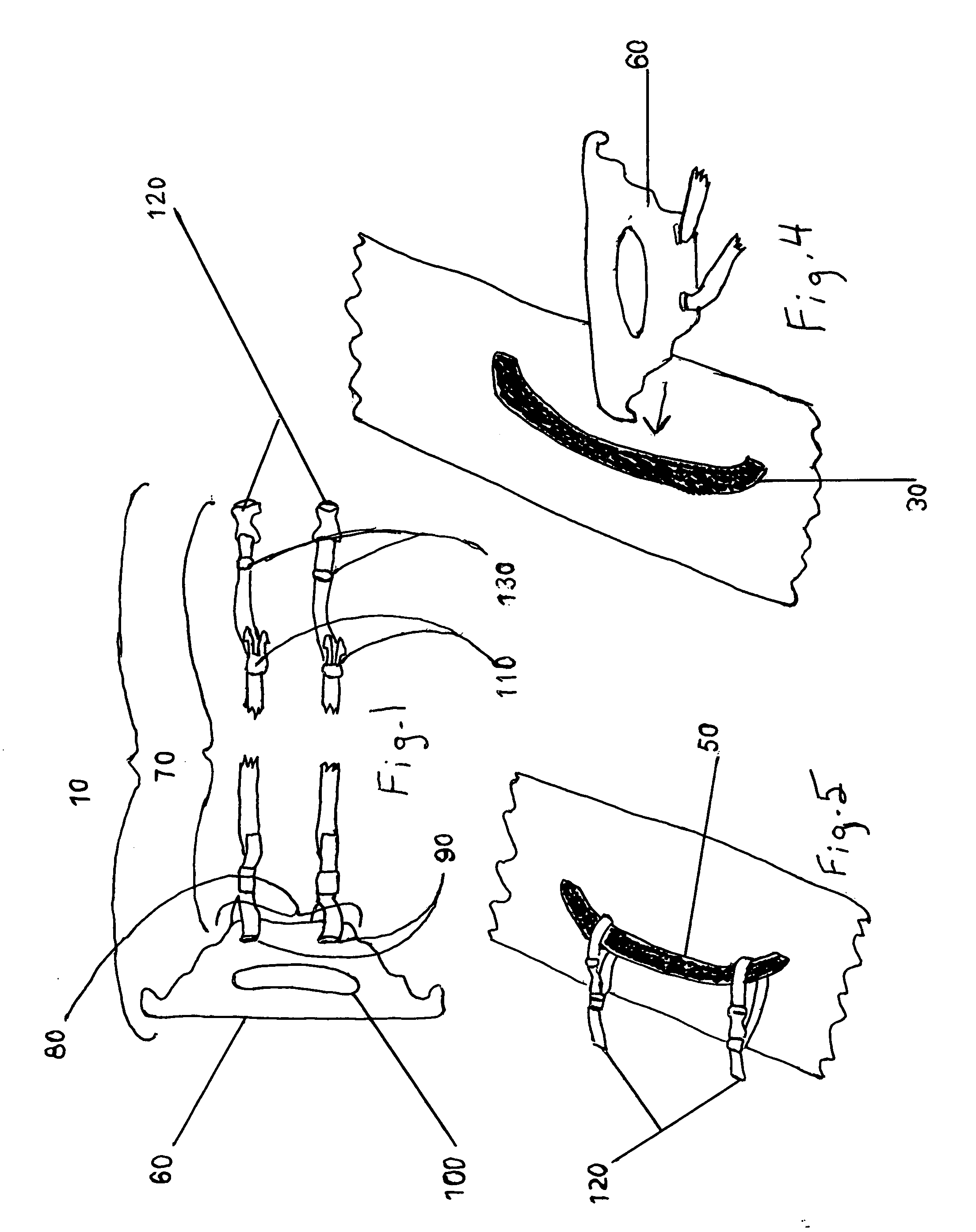 Luggage coupler