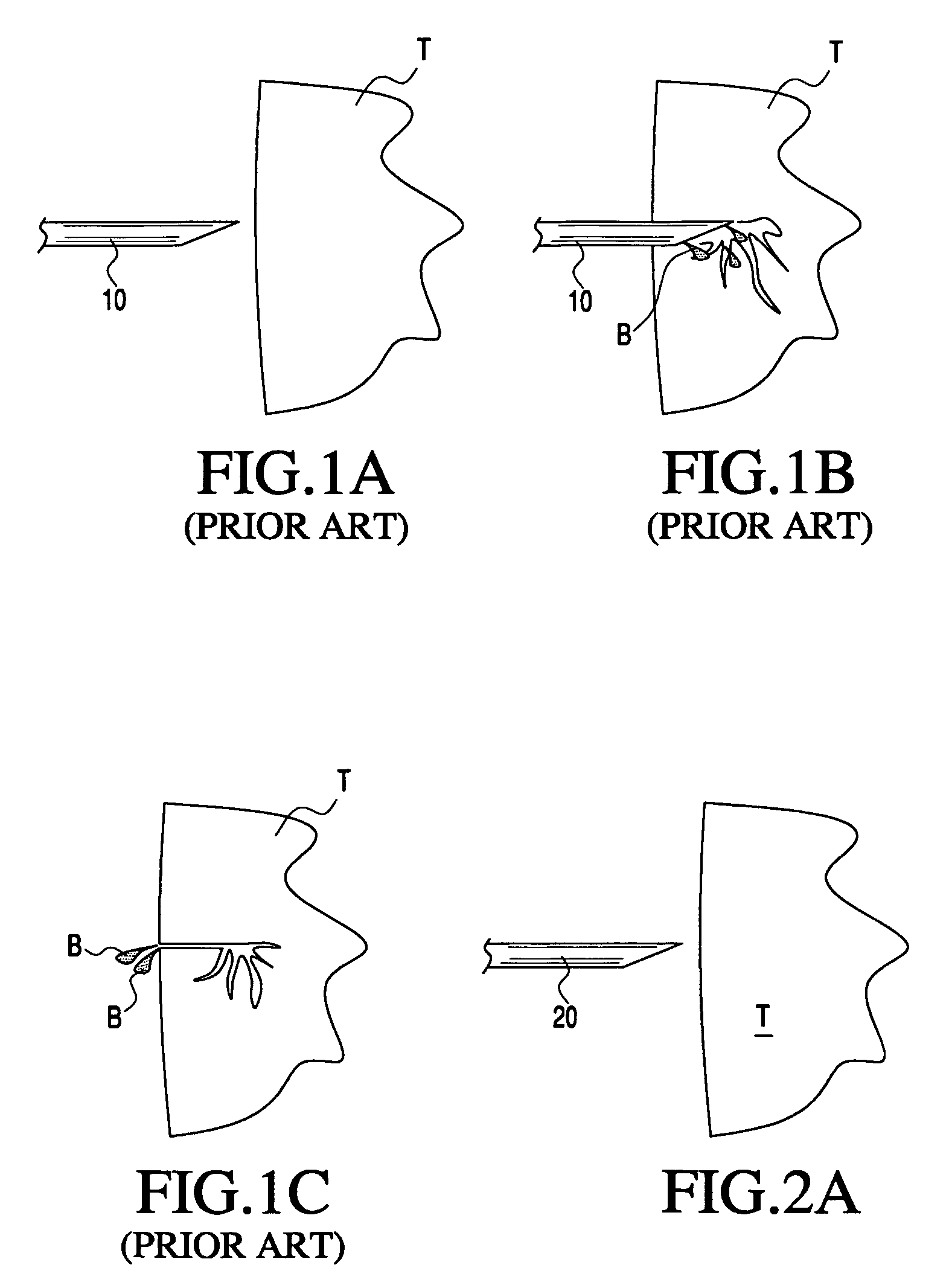 Apparatus and methods for treating tissue using passive injection systems