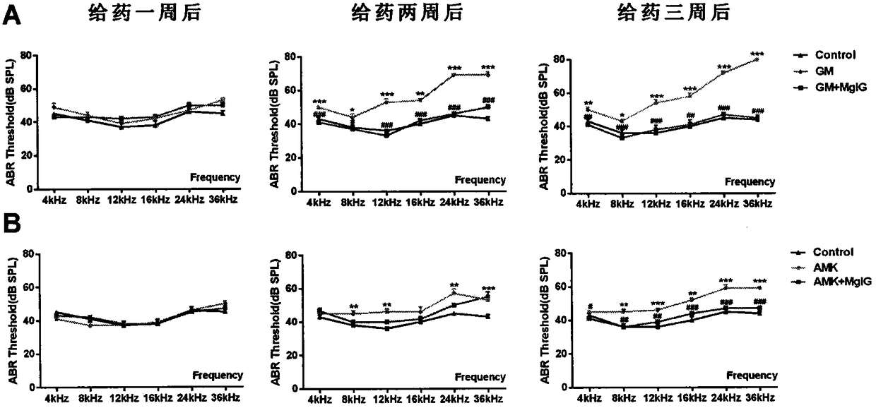 Application of magnesium isoglycyrrhizinate to preparation of medicine for lowering ototoxicity caused by aminoglycoside antibiotics