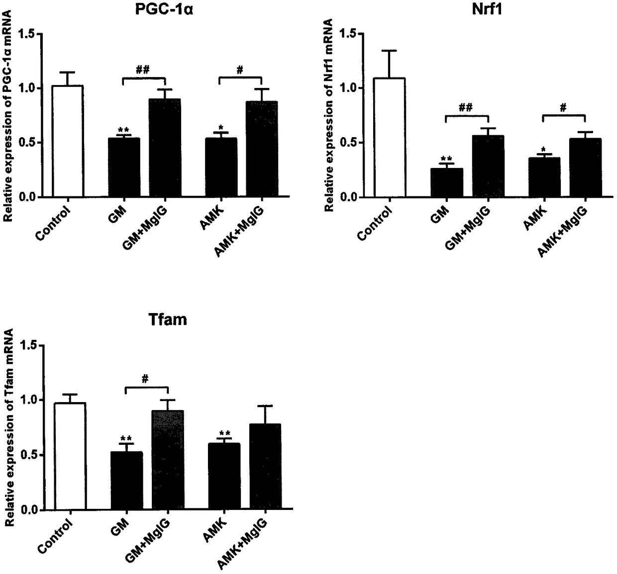 Application of magnesium isoglycyrrhizinate to preparation of medicine for lowering ototoxicity caused by aminoglycoside antibiotics