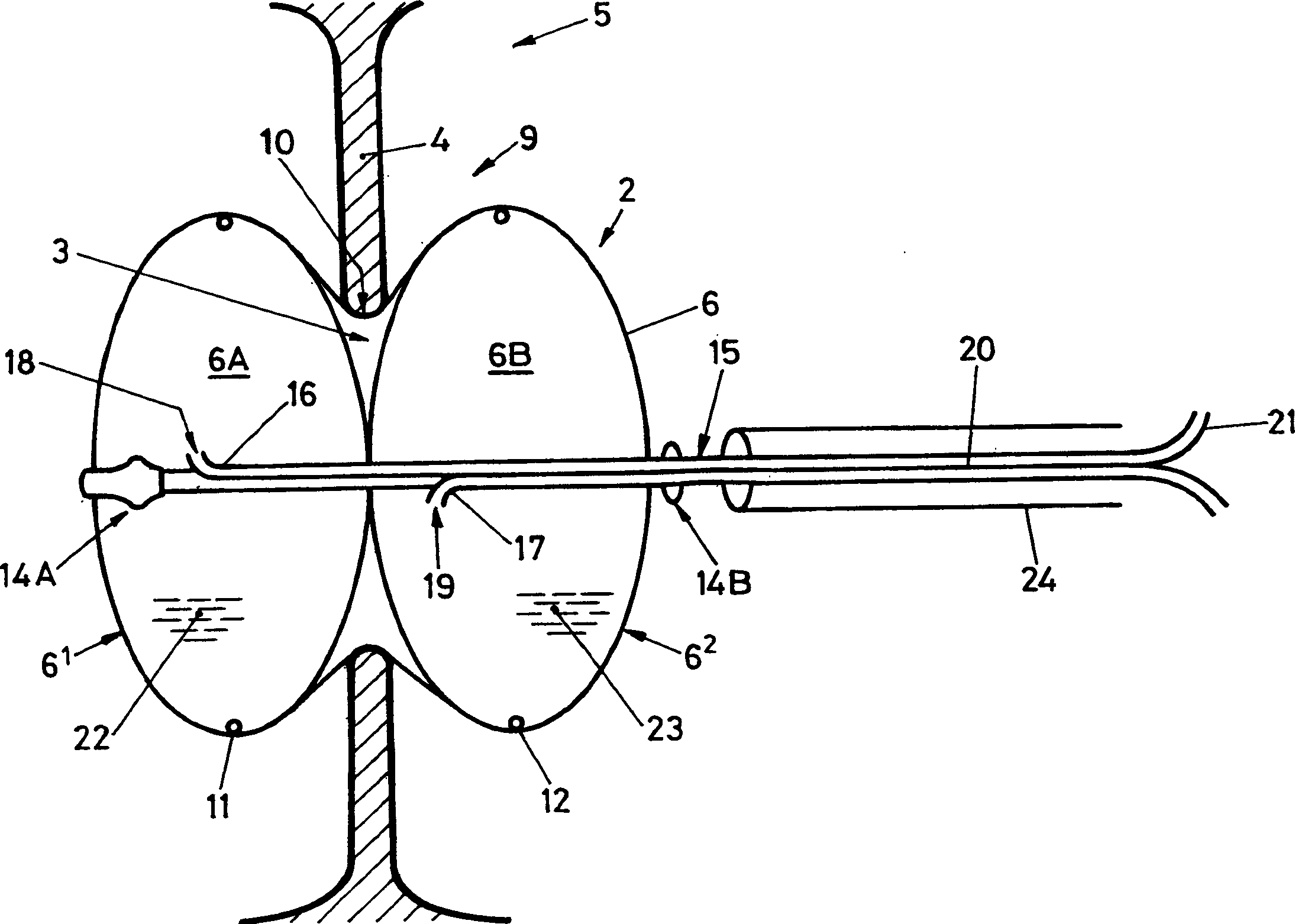 A device for plugging an opening such as in a wall of a hollow or tubular organ