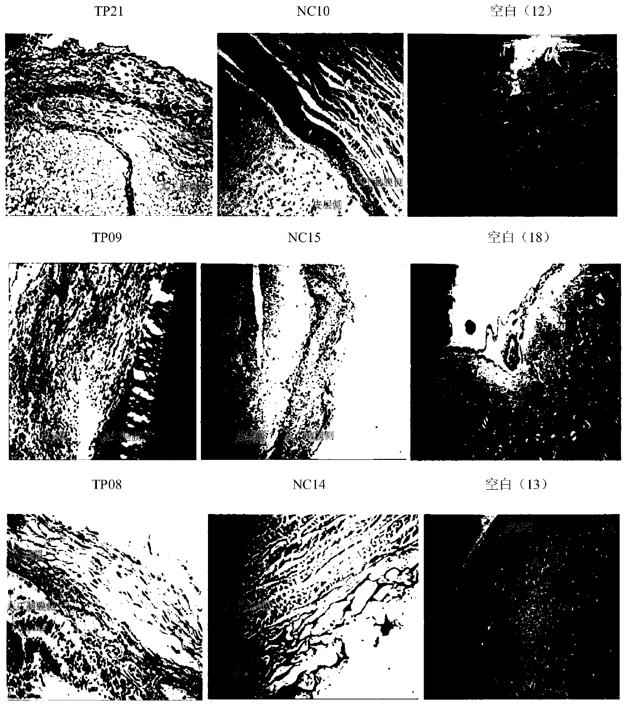 A kind of dura mater patch, preparation method and application in repairing of dura mater injury