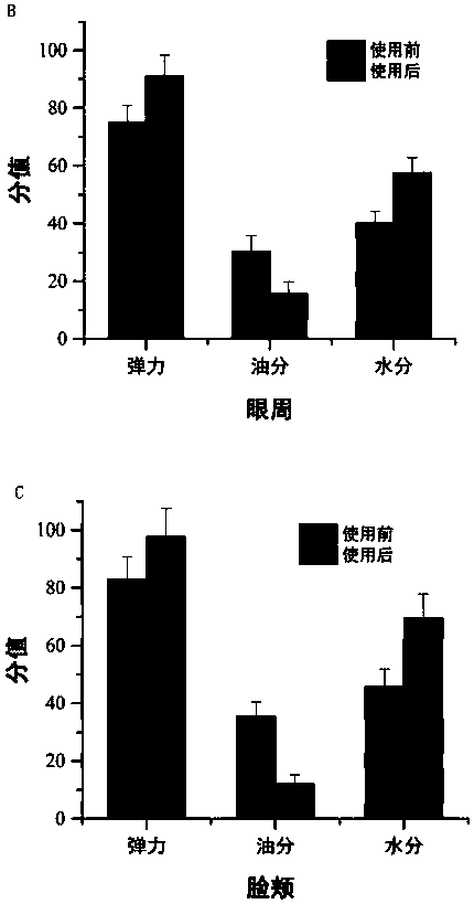 European bilberry enzyme prepared from composite biological enzymes and preparation method and application thereof