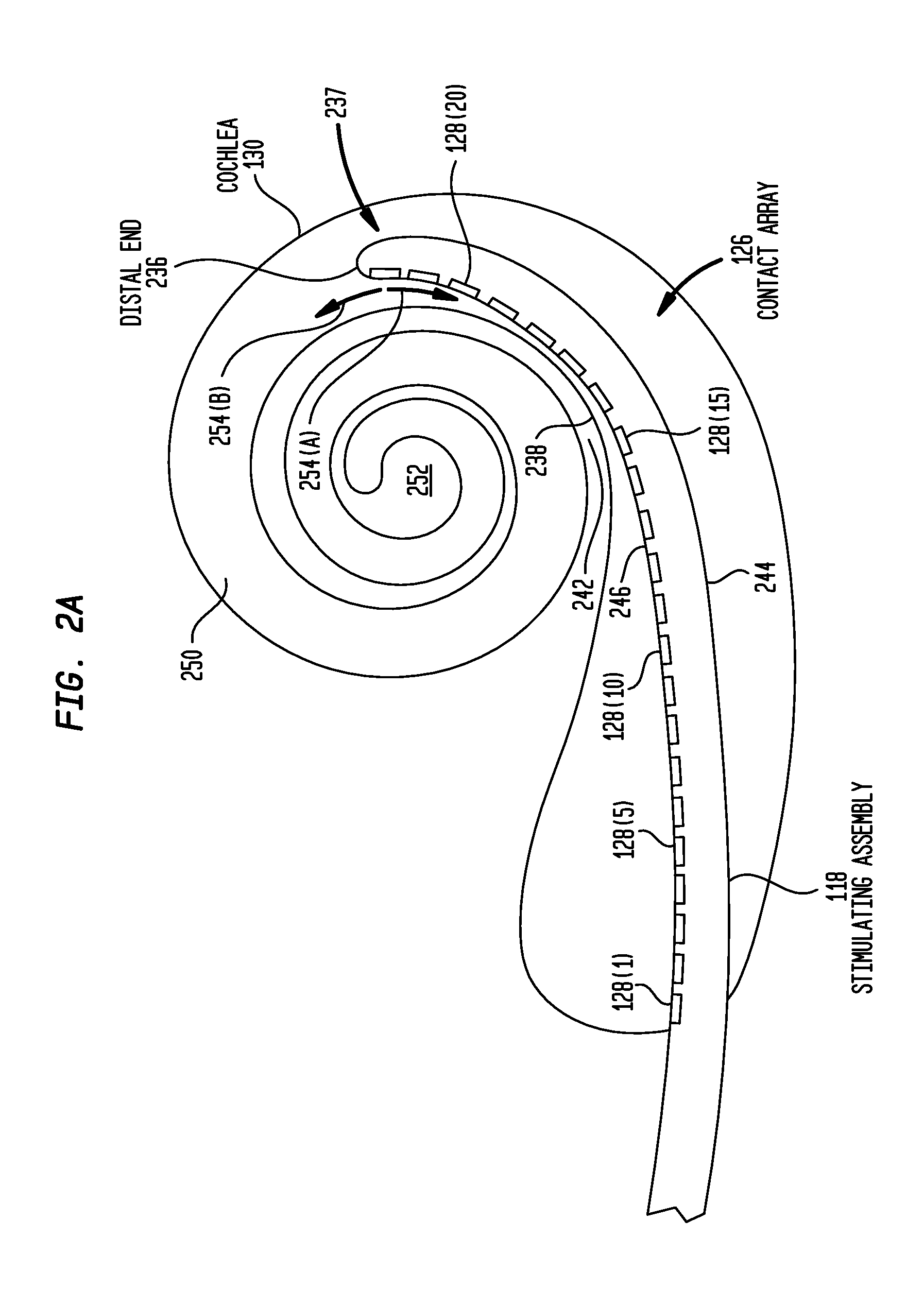 Event Detection In An Implantable Auditory Prosthesis