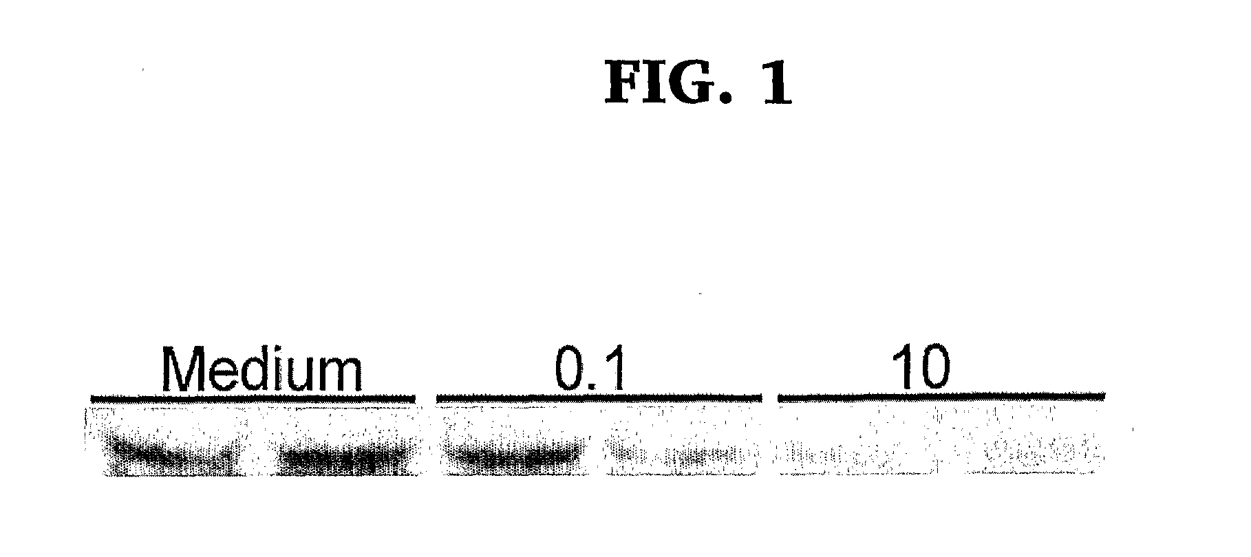 Milk Fat Globule Epidermal Growth Factor-Factor VIII And Sepsis