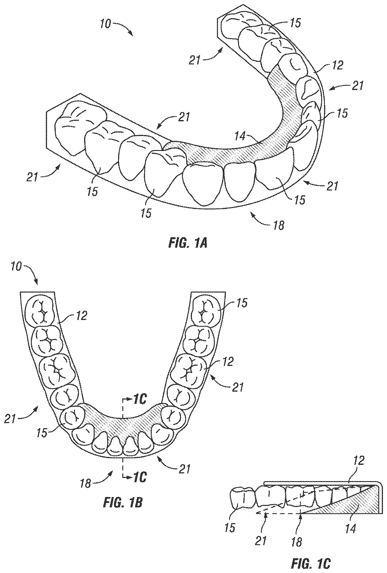 Lingual positioning device for sleep, breathing, jaw and airway disorders