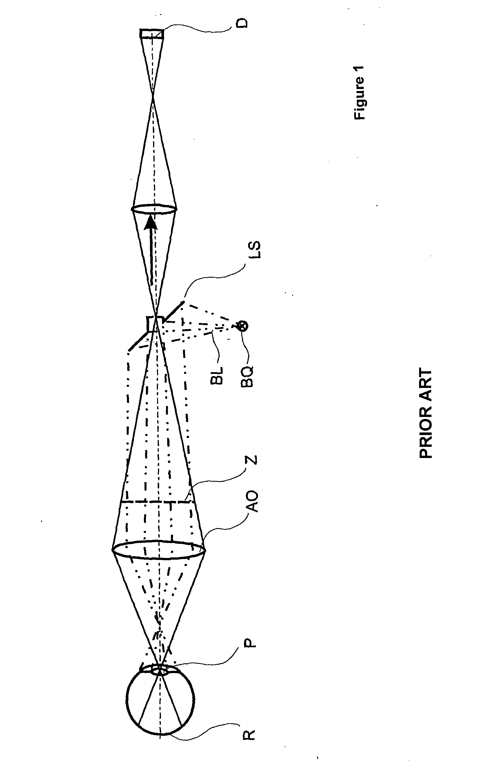 Ophthalmologic apparatus and method for the observation, examination, diagnosis, and/or treatment of an eye