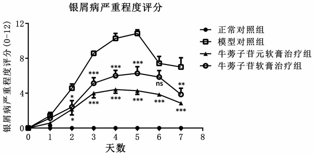 Application of arctiin and arctigenin in preparation of medicine for treating and/or preventing skin inflammations