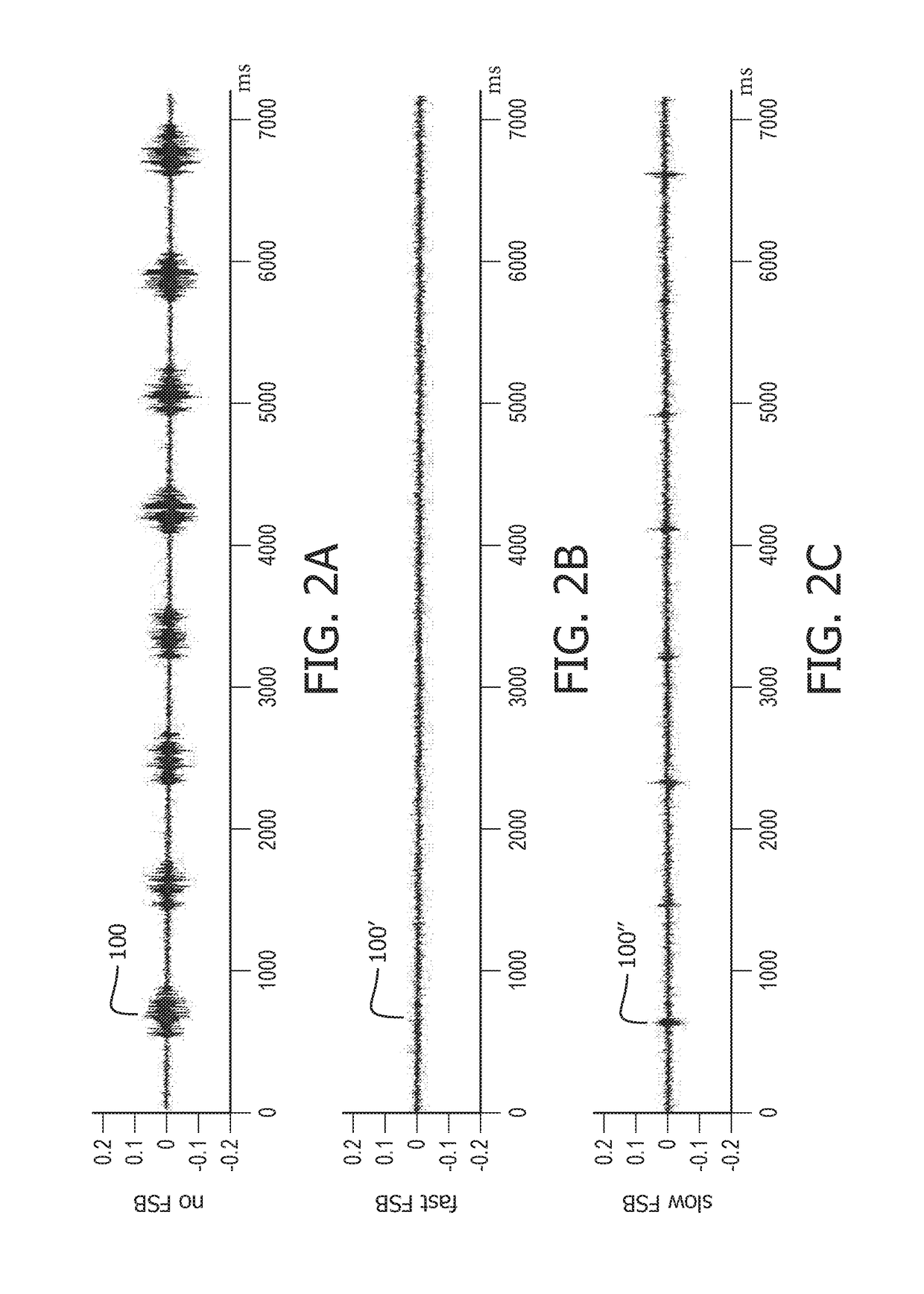 Sleep apnea diagnosis system and method of generating information using non-obtrusive audio analysis