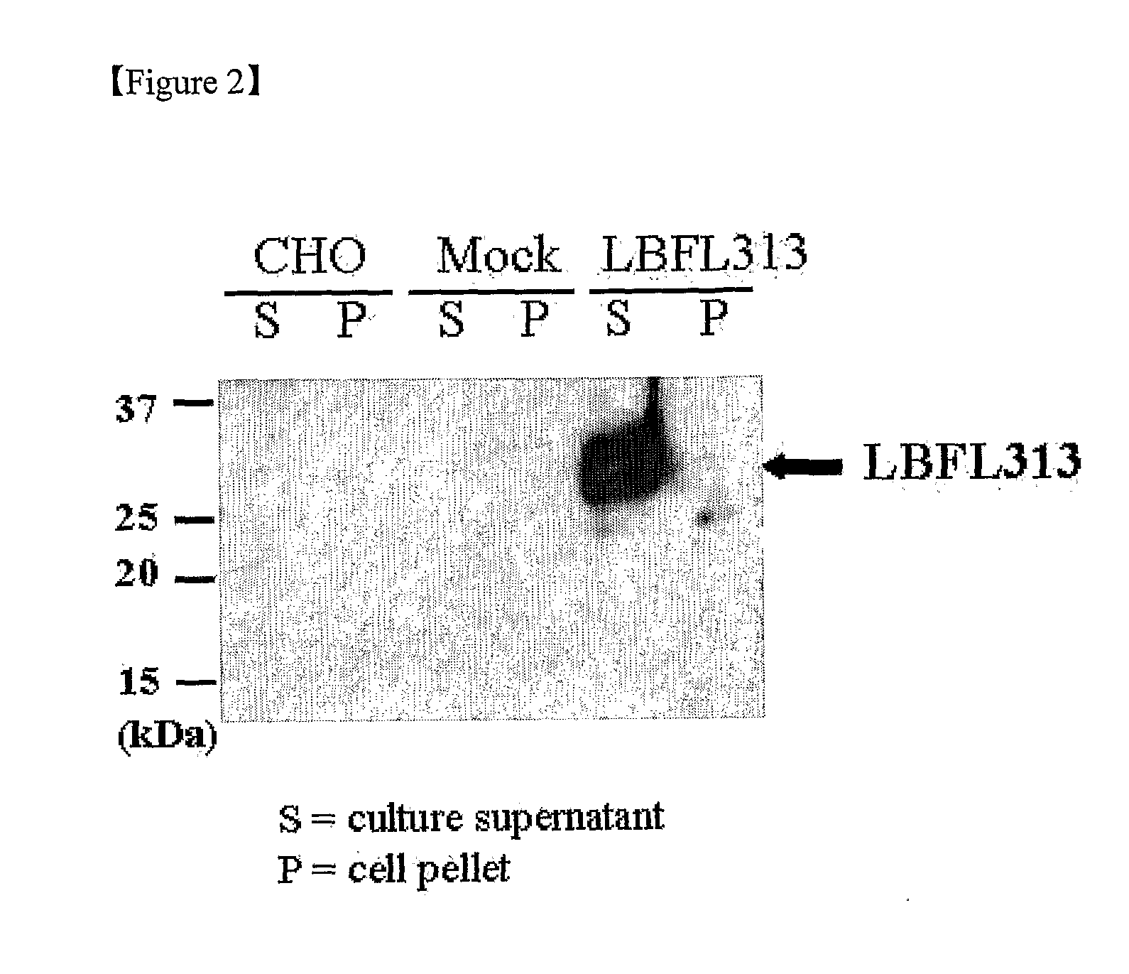 Gene family (lbfl313) associated with pancreatic cancer