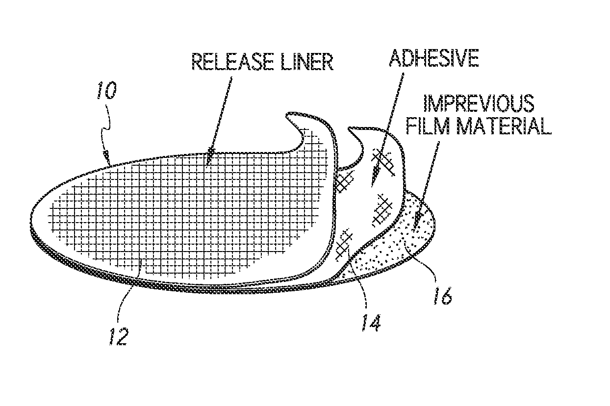 Systems and methods for treating female incontinence and pelvic nerve dysfunction