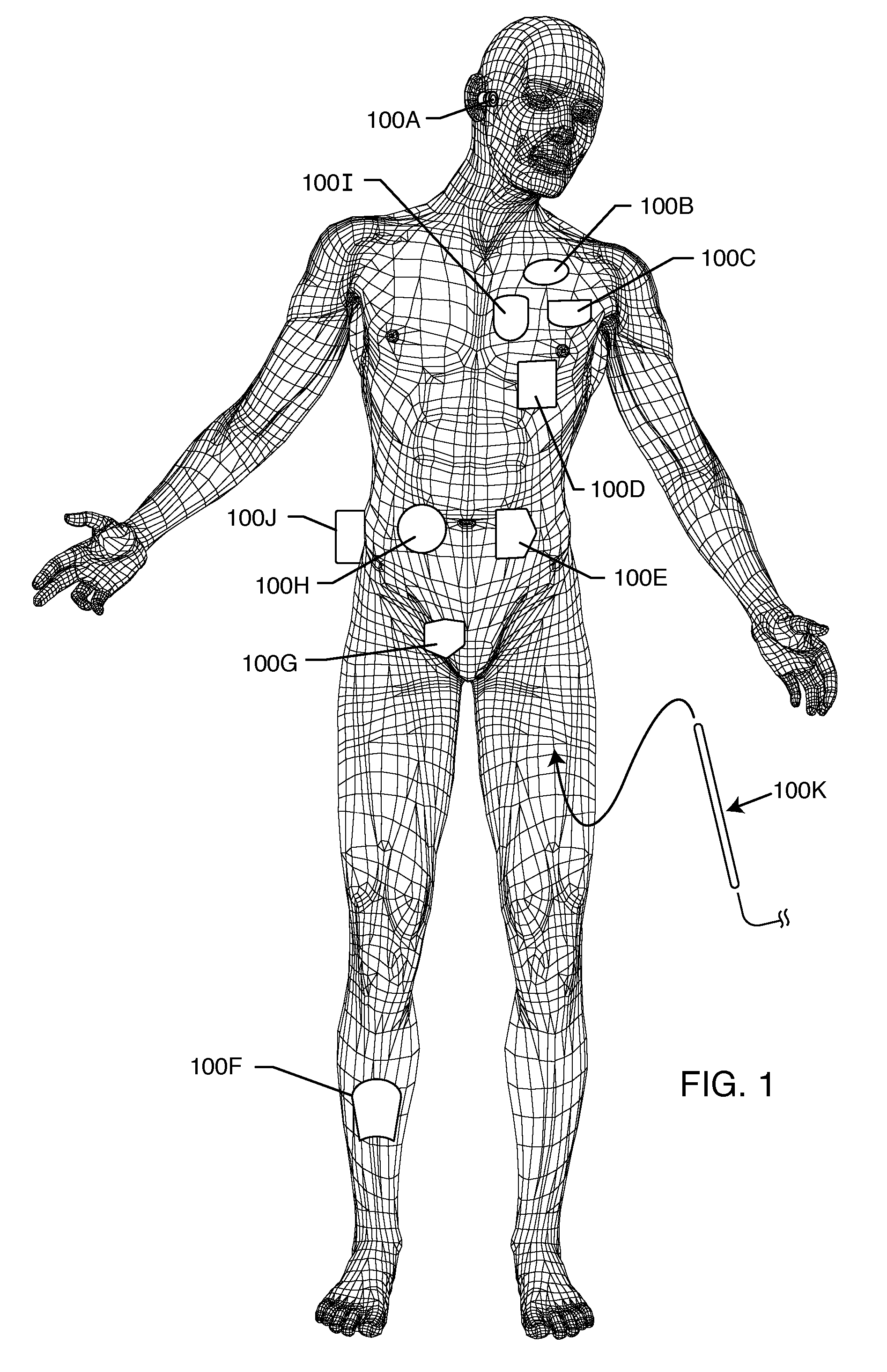 Band stop filter employing a capacitor and an inductor tank circuit to enhance MRI compatibility of active medical devices