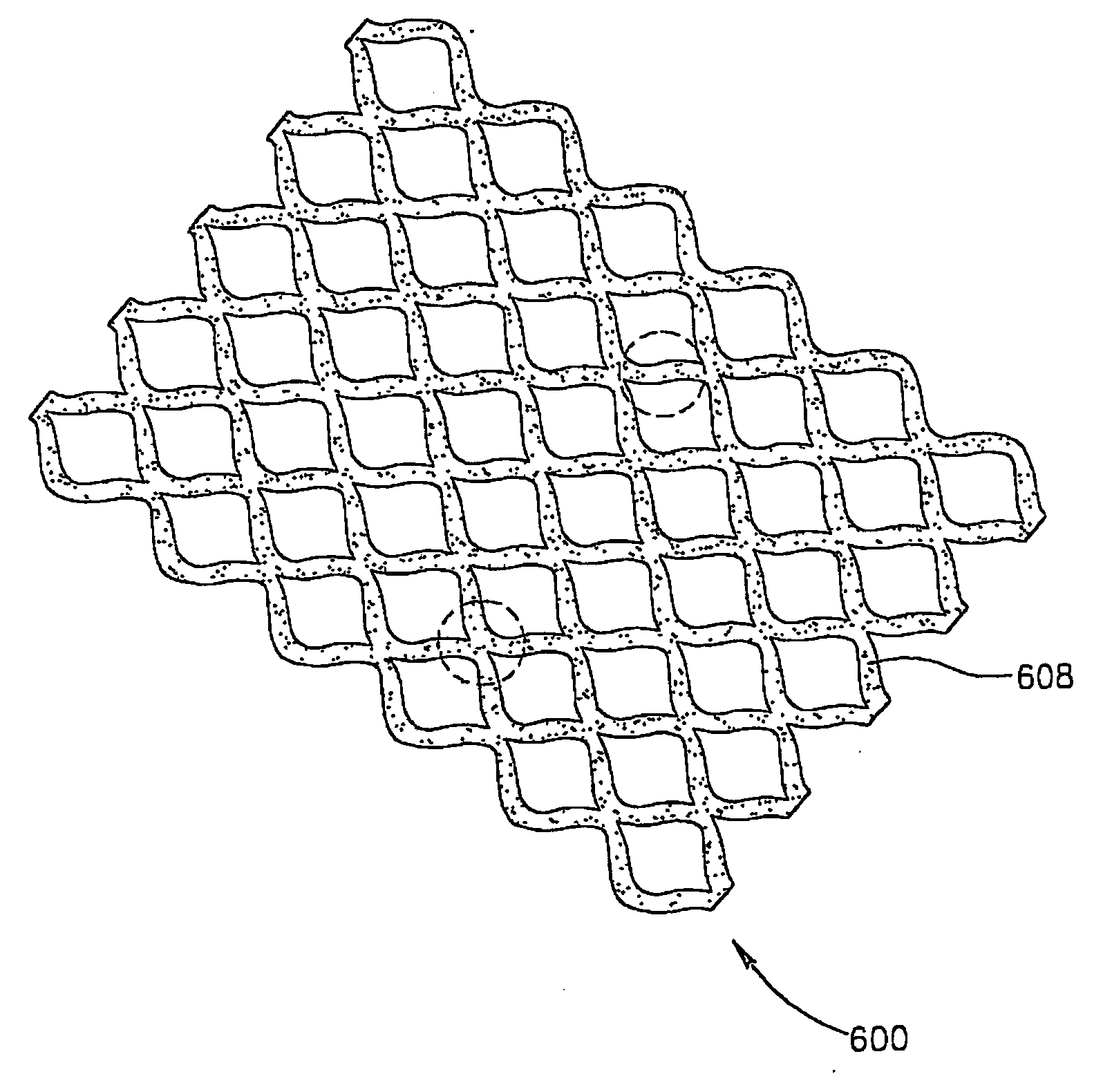 Method and apparatus for production of a skin graft and the graft produced thereby