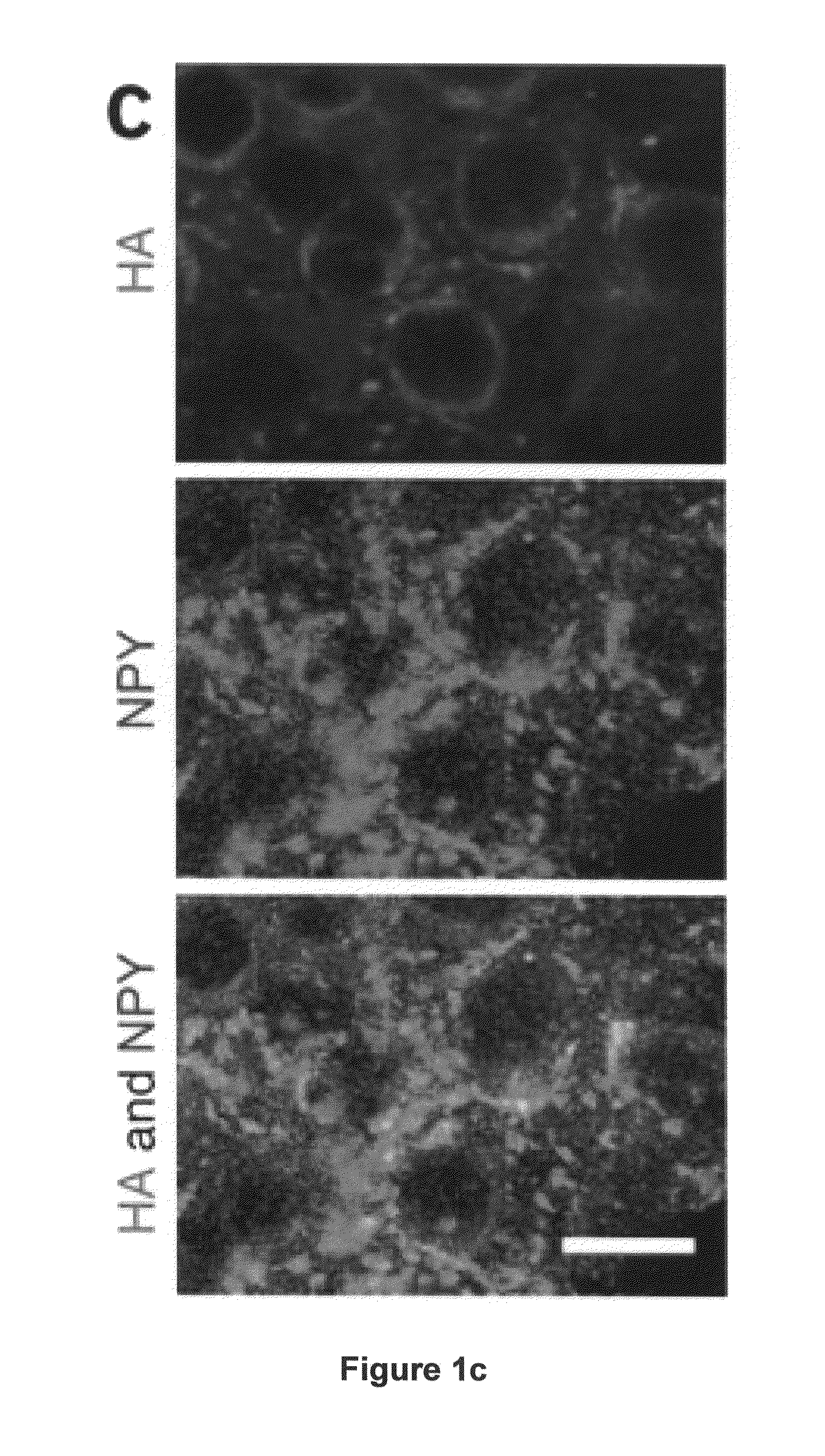 Treatment of Metabolic-Related Disorders Using Hypothalamic Gene Transfer of BDNF and Compositions Therefor