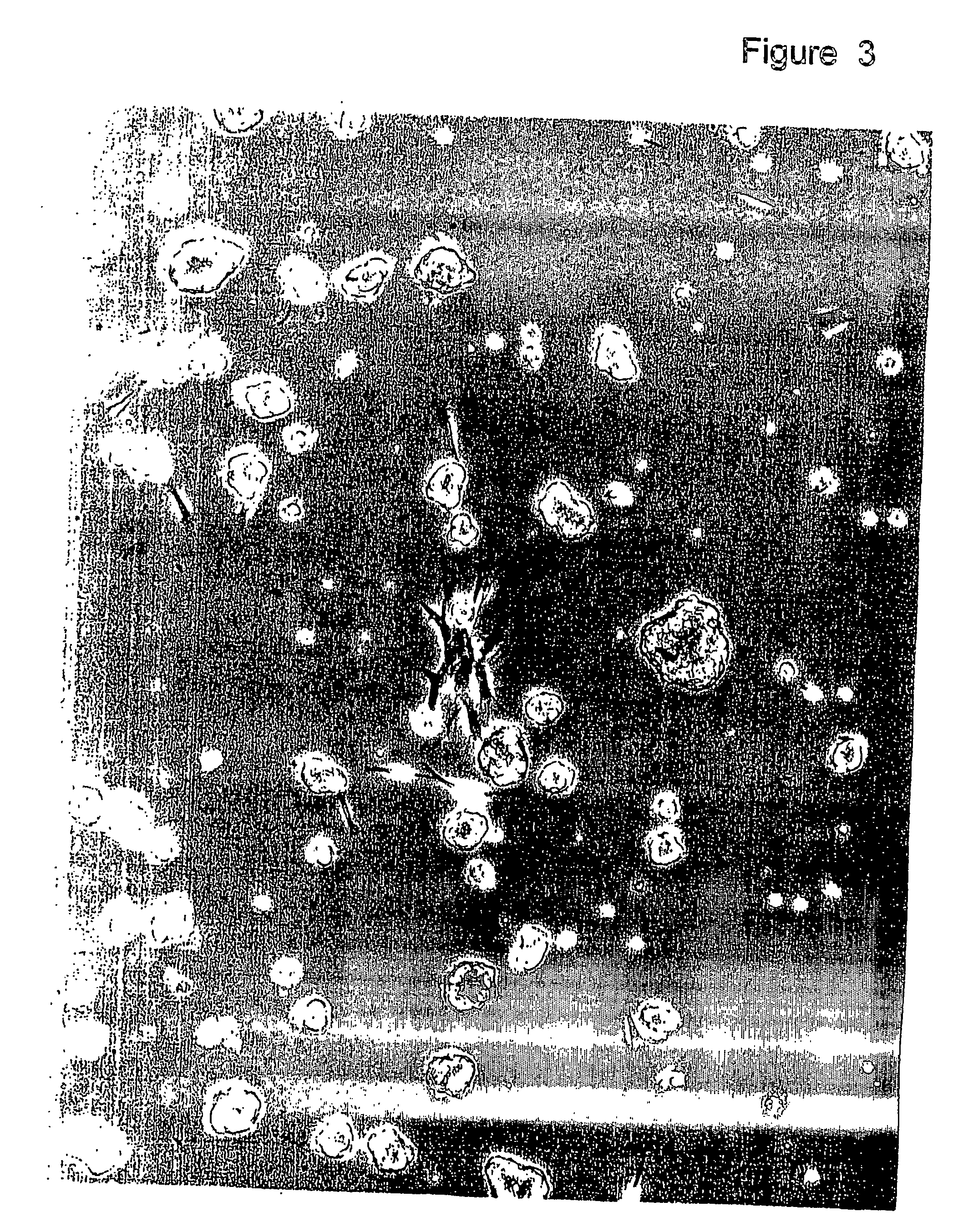 Extraction and use of collagen extracted from either a sea mammal or a bony fish