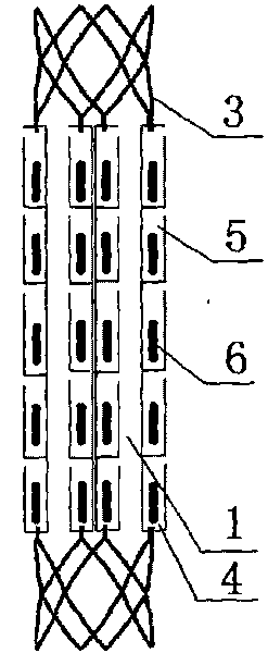 Biliary tract radiation treatment stent