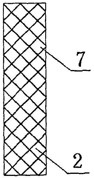 Biliary tract radiation treatment stent