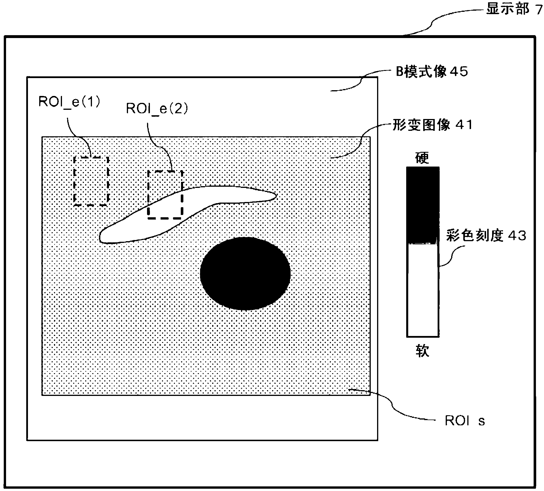 Ultrasound diagnostic apparatus and method