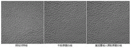 Recombinant human collagen and its coding gene and preparation method thereof