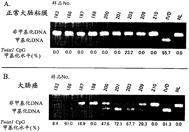 Methods for the detection of colorectal tumors