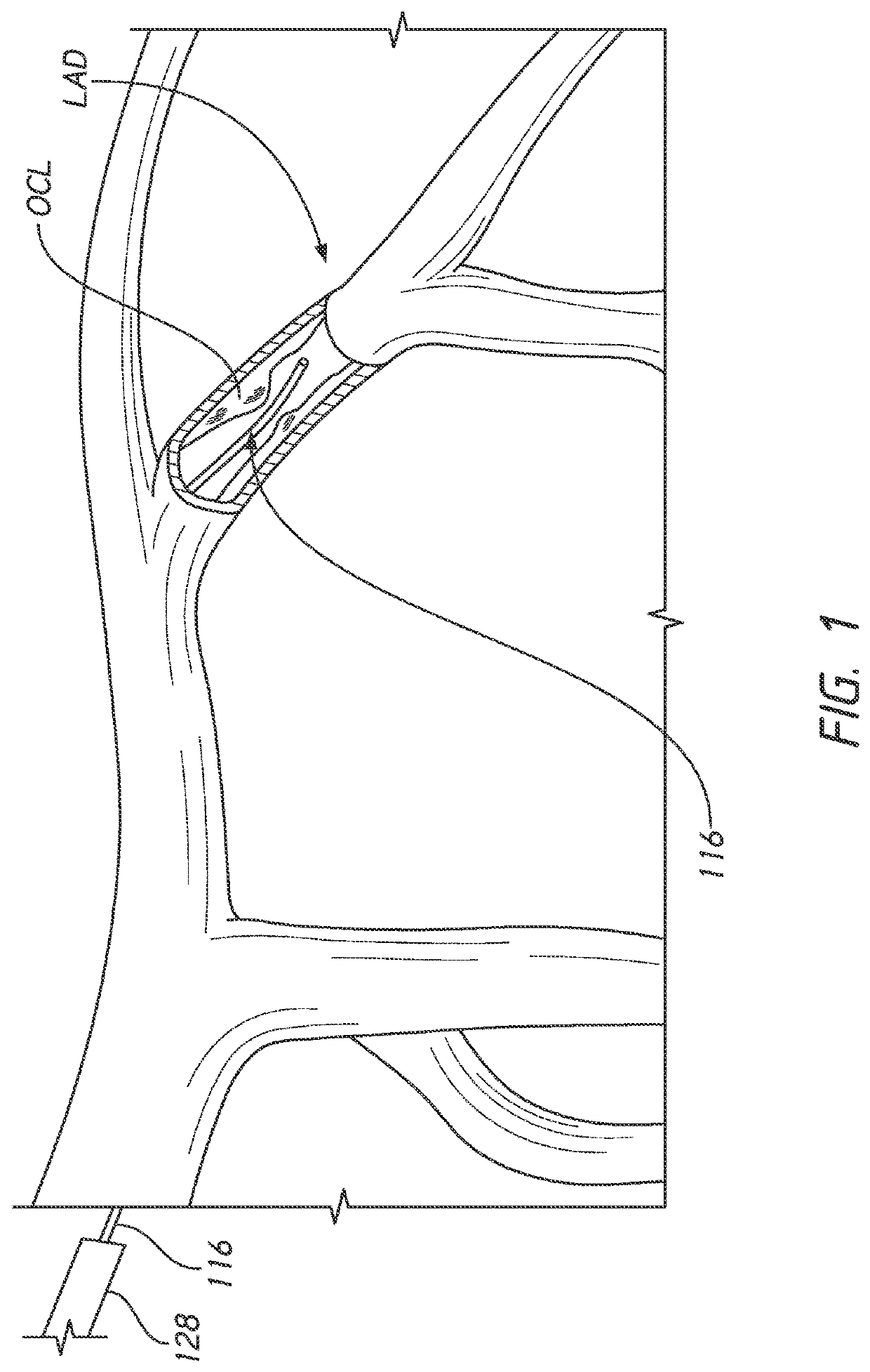 Guidewire with internal pressure sensor