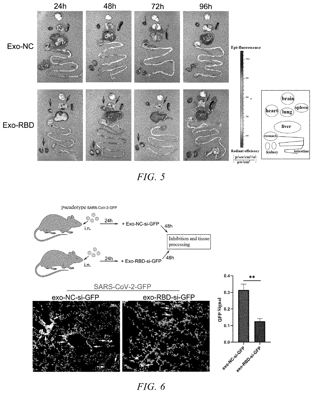 Targeted exosome based on rbd region of sars-cov-2 s protein and preparation method thereof