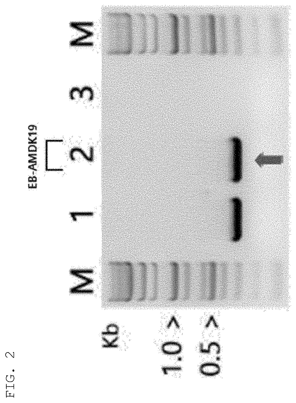 Akkermansia muciniphila eb-amdk19 strain and use thereof