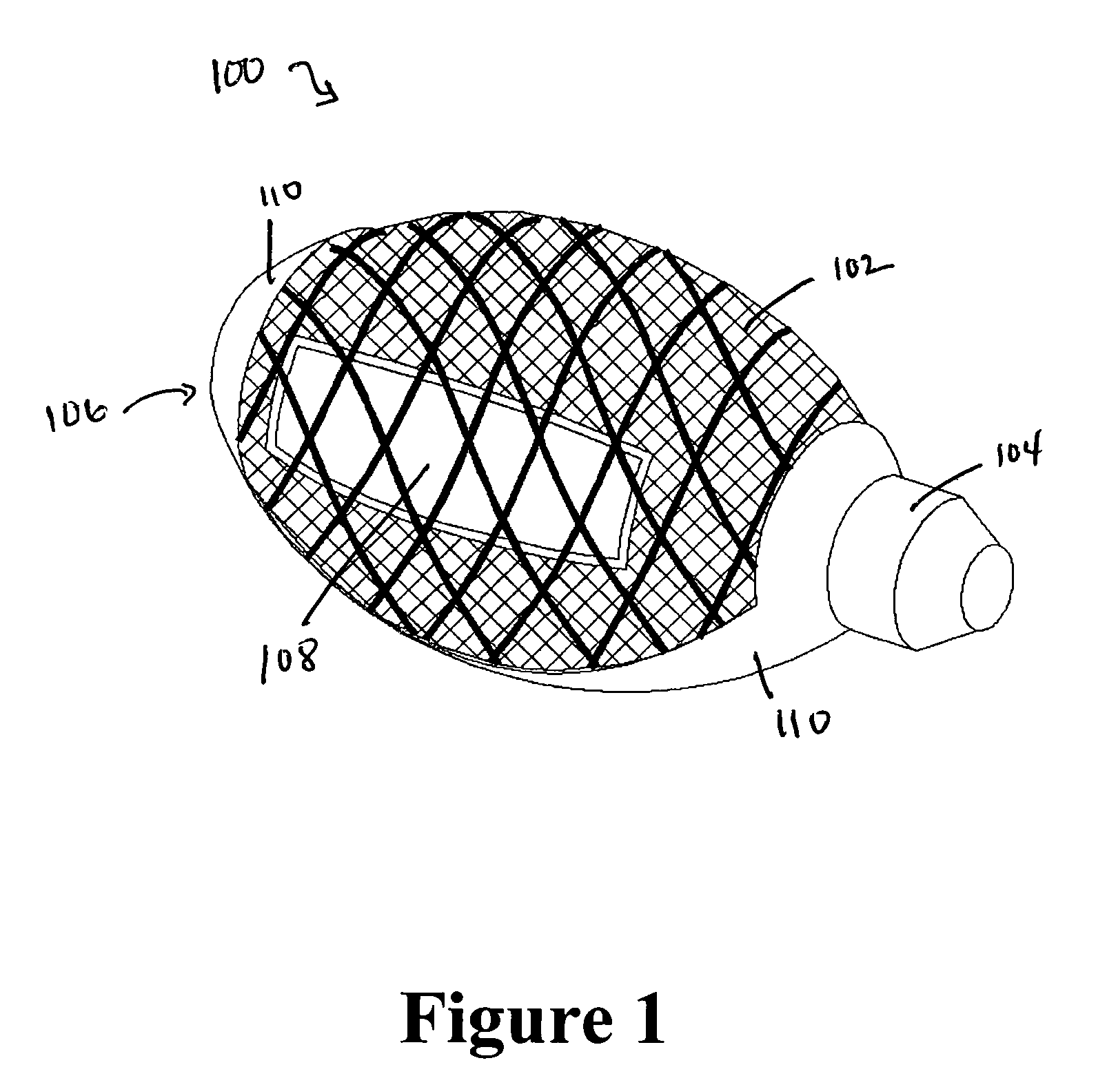 Cement-directing orthopedic implants