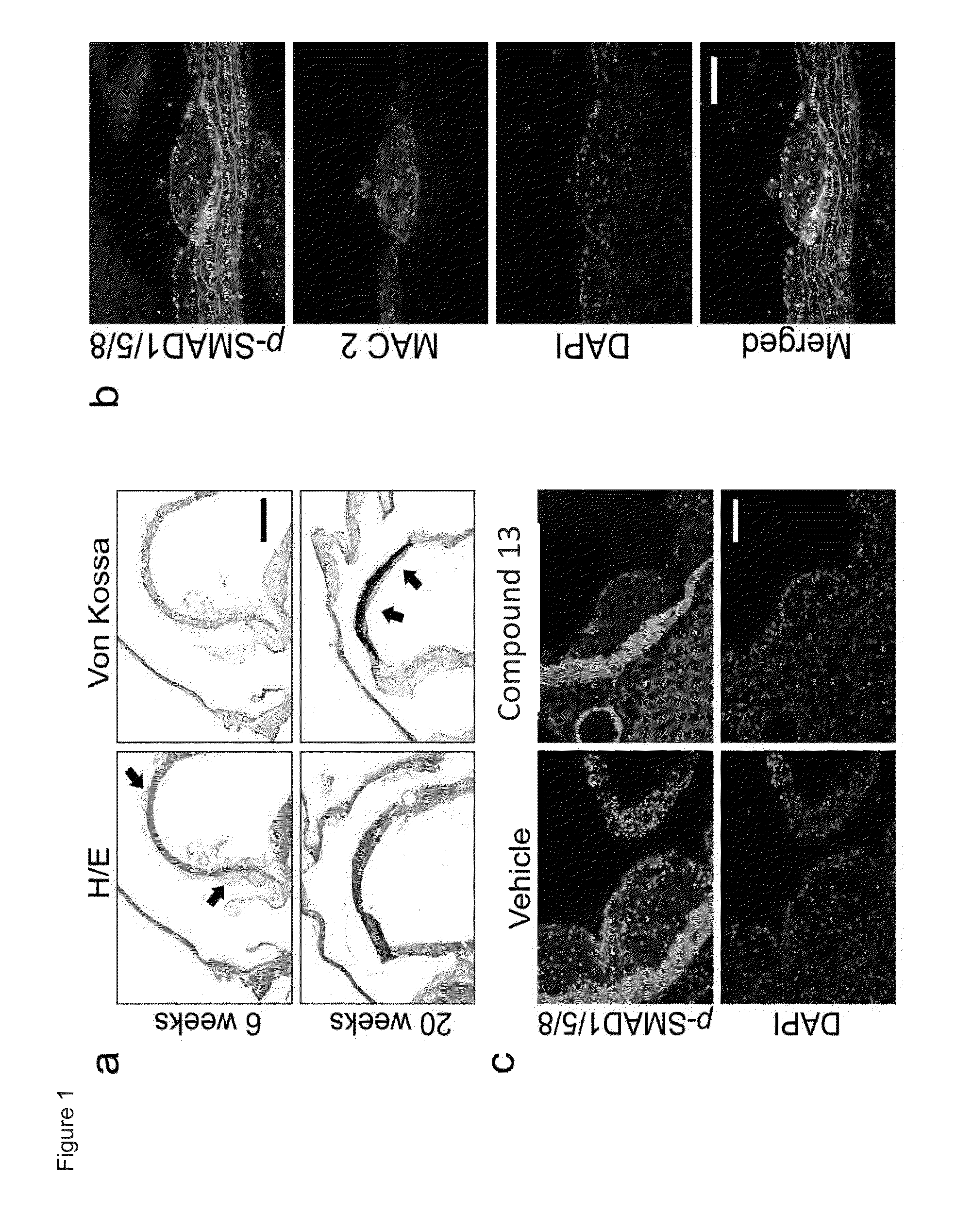 Compositions and methods for cardiovascular disease