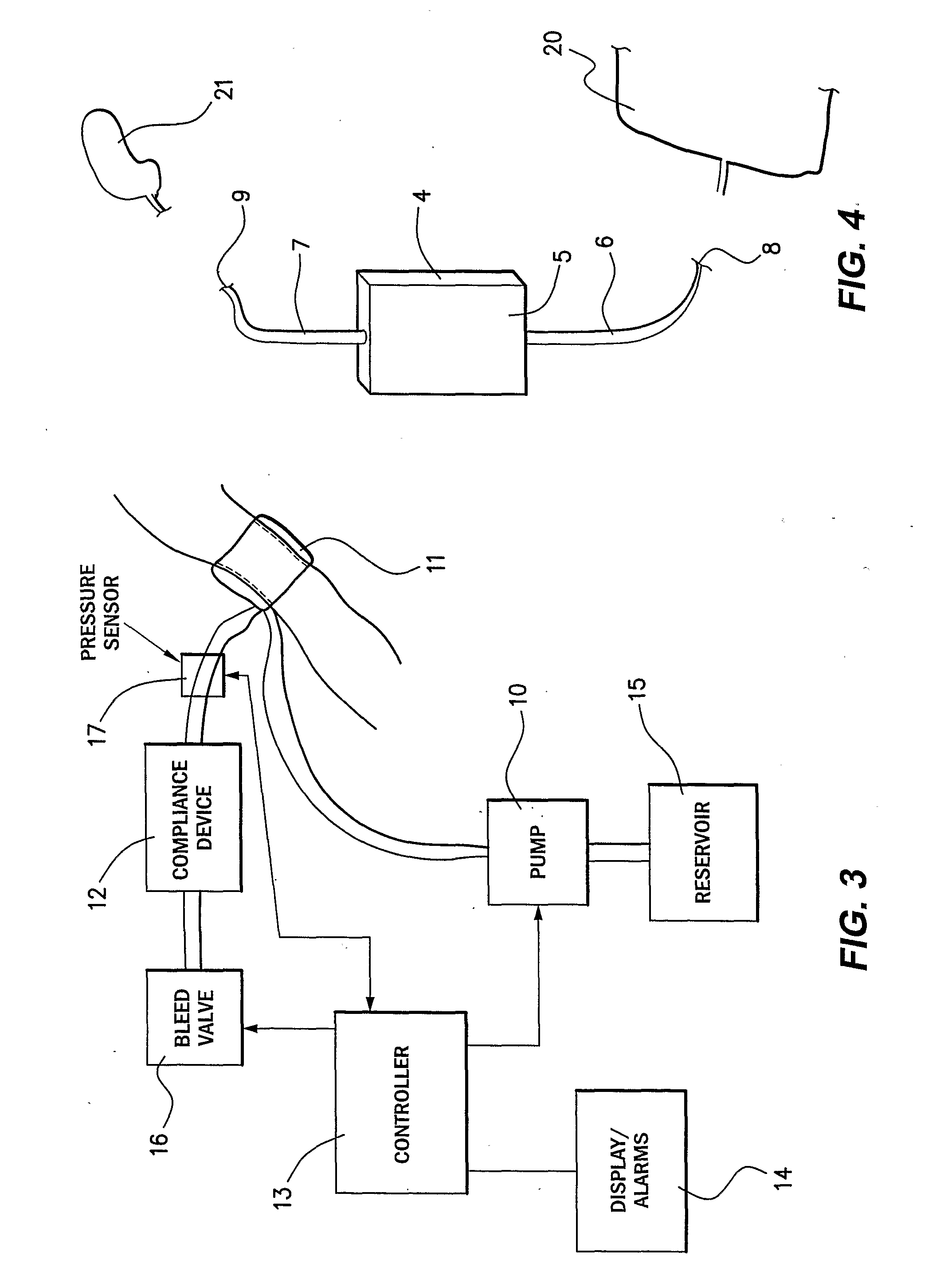 Blood pressure monitor