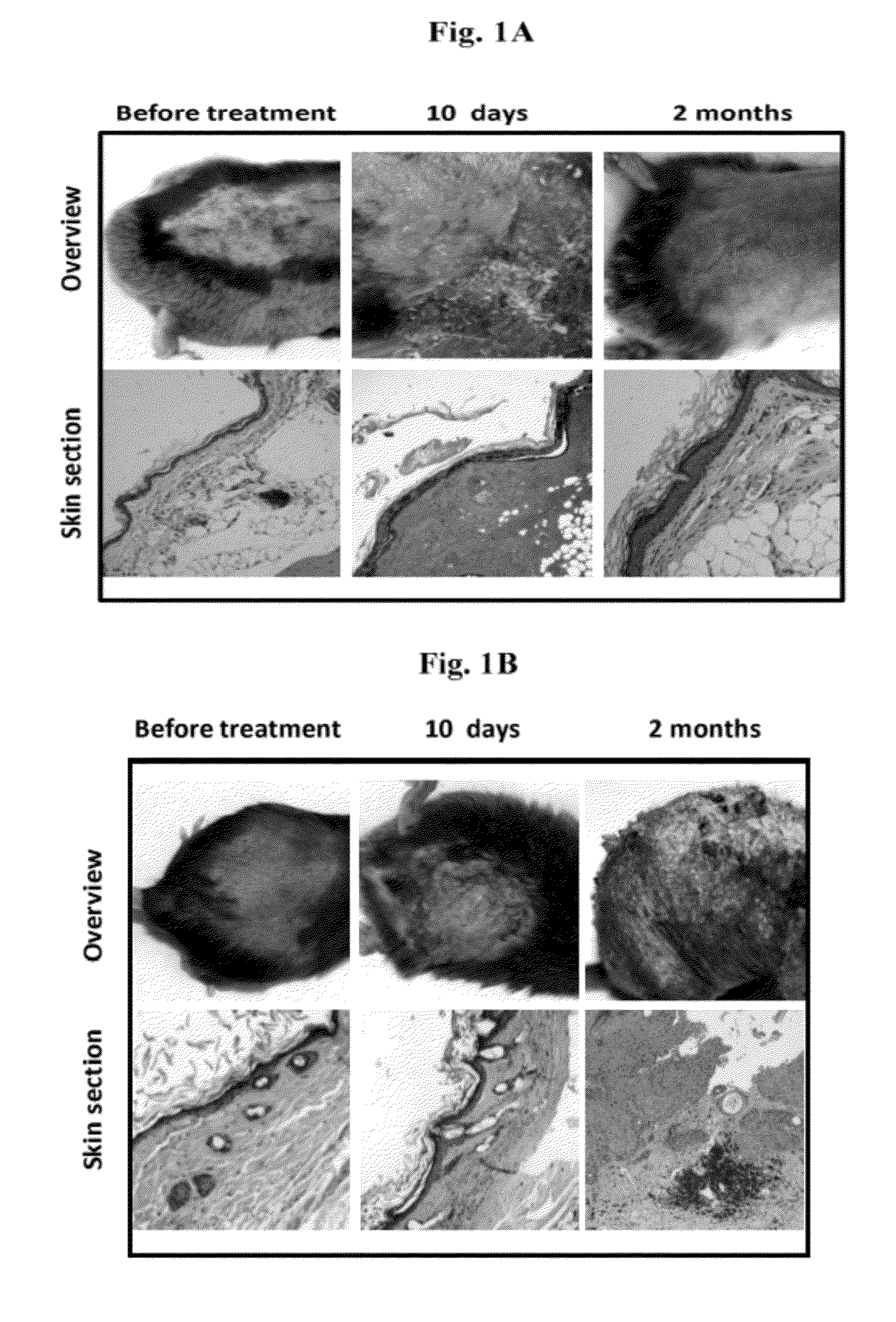 Spalax fibroblast-derived Anti-cancer agents