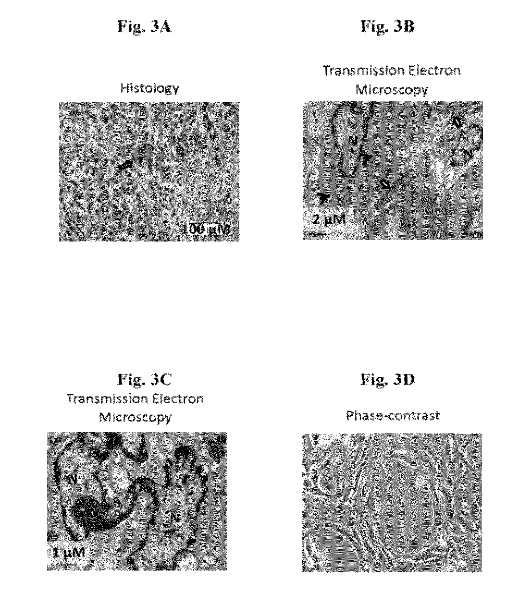 Spalax fibroblast-derived Anti-cancer agents