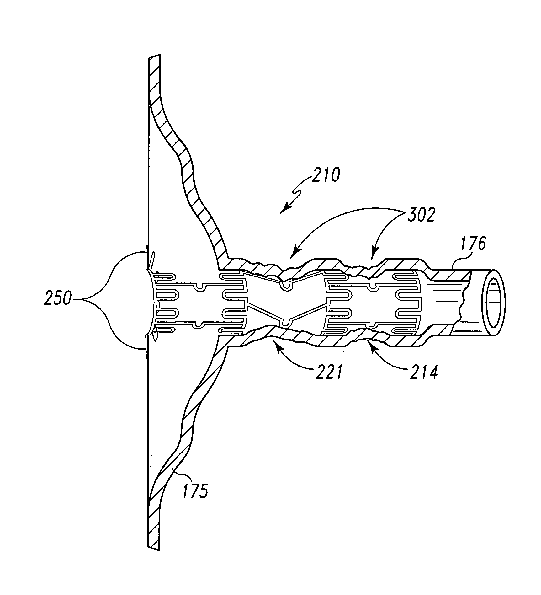 Fenestrated endoluminal stent system