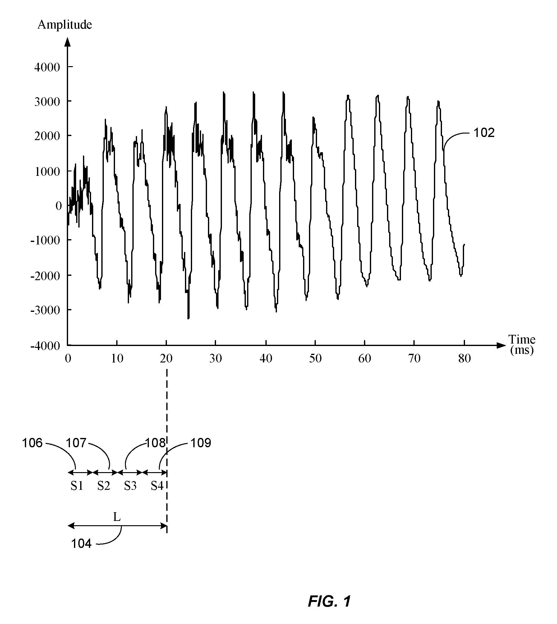 Dual-transform coding of audio signals