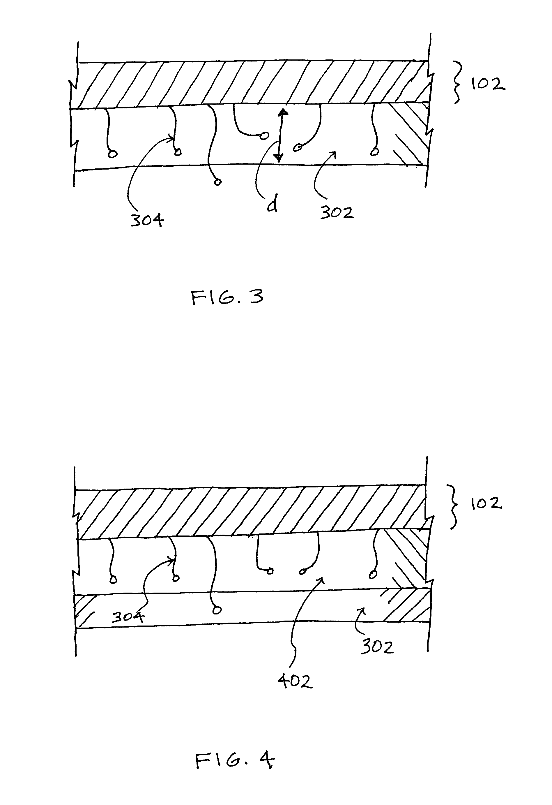 Reinforcement device with dissolvable layer and its use