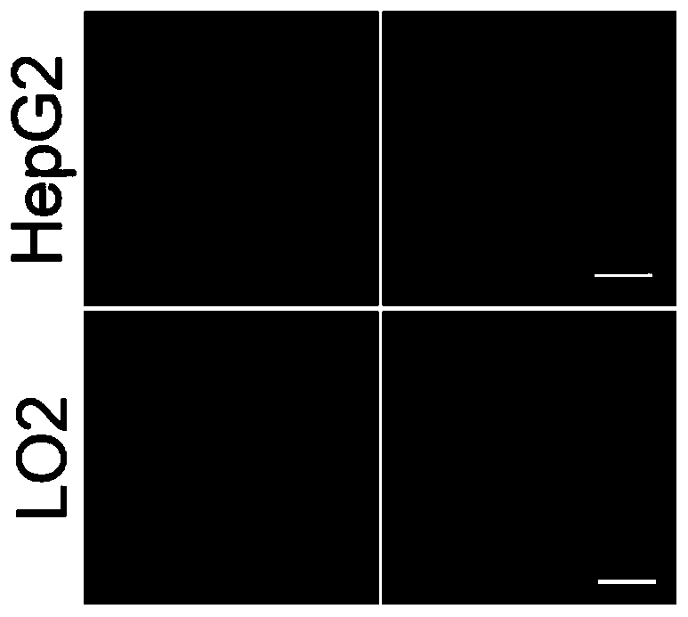 Leucine aminopeptidase and monoamine oxidase-activated near-infrared fluorescent probe as well as synthetic method and biological application thereof