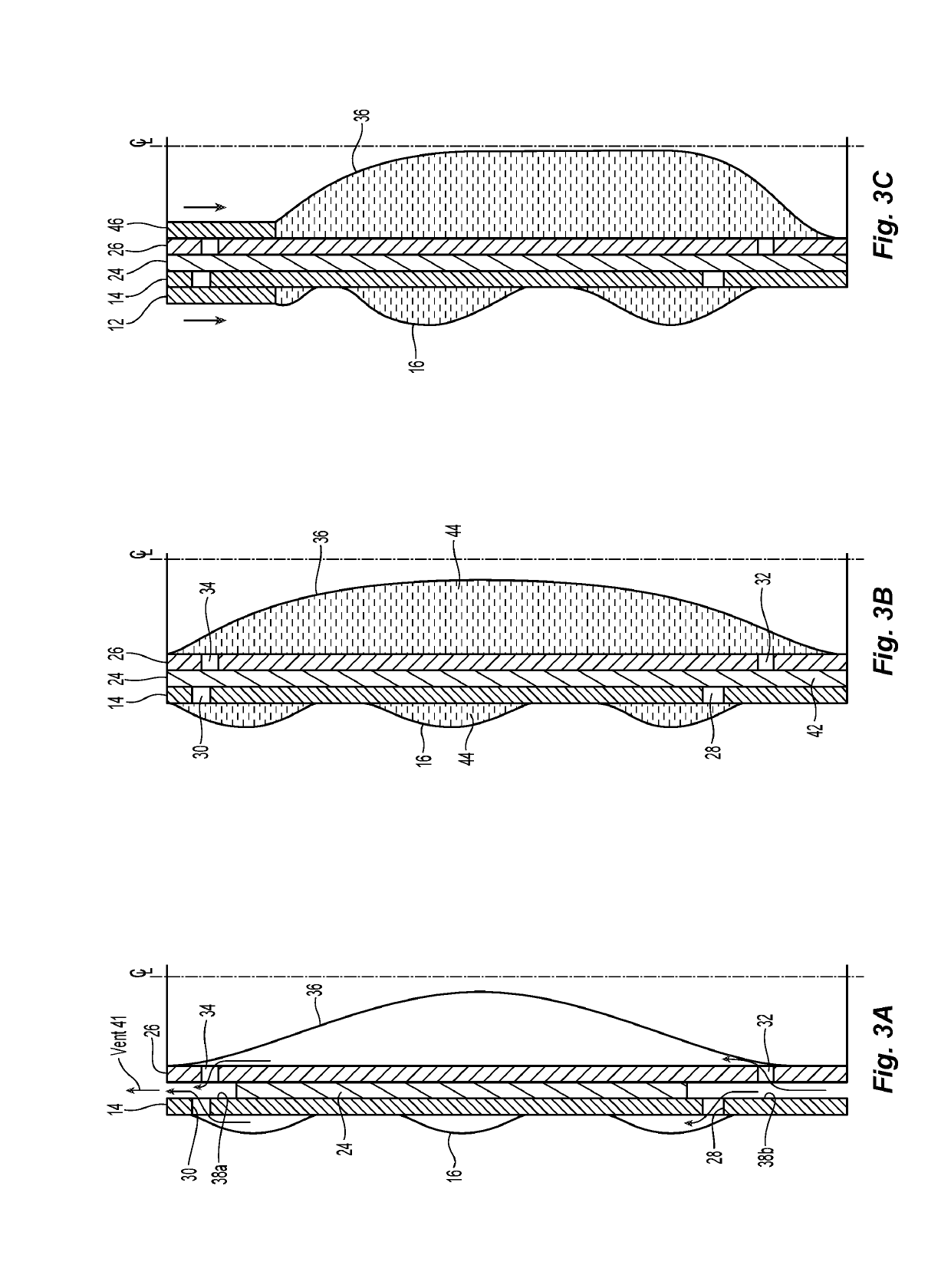 Surgical cannula with bellows