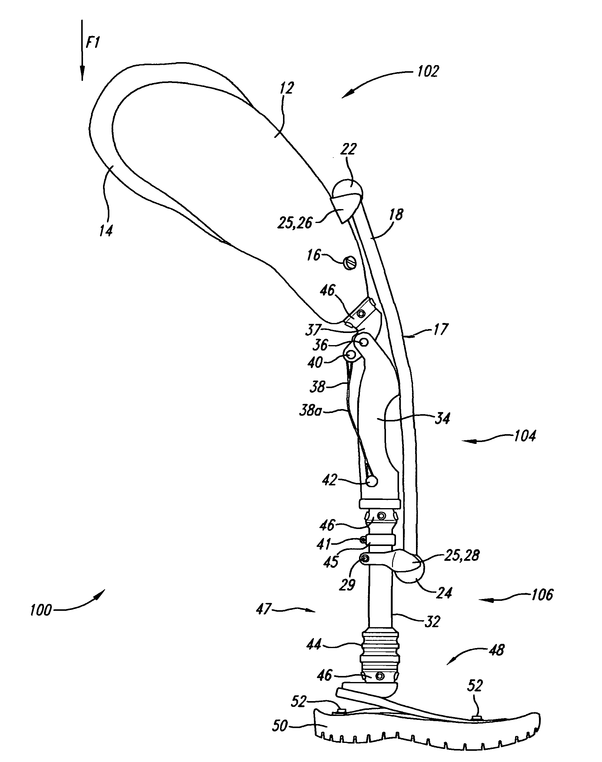 Limb prosthesis system and method