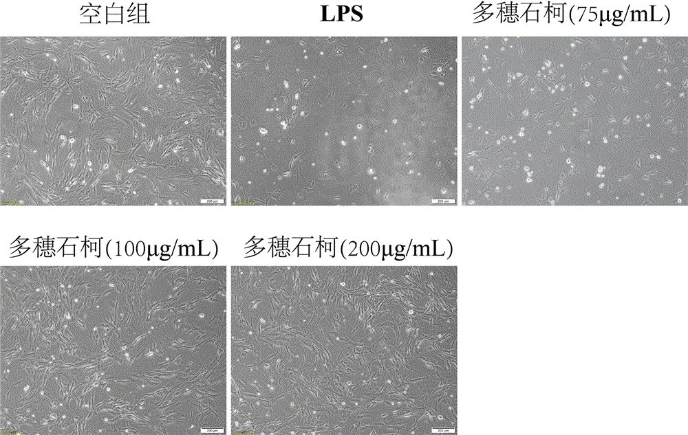 Application of Lithocarpus polystachyus (Wall.) Rehd. in preparing toothpaste