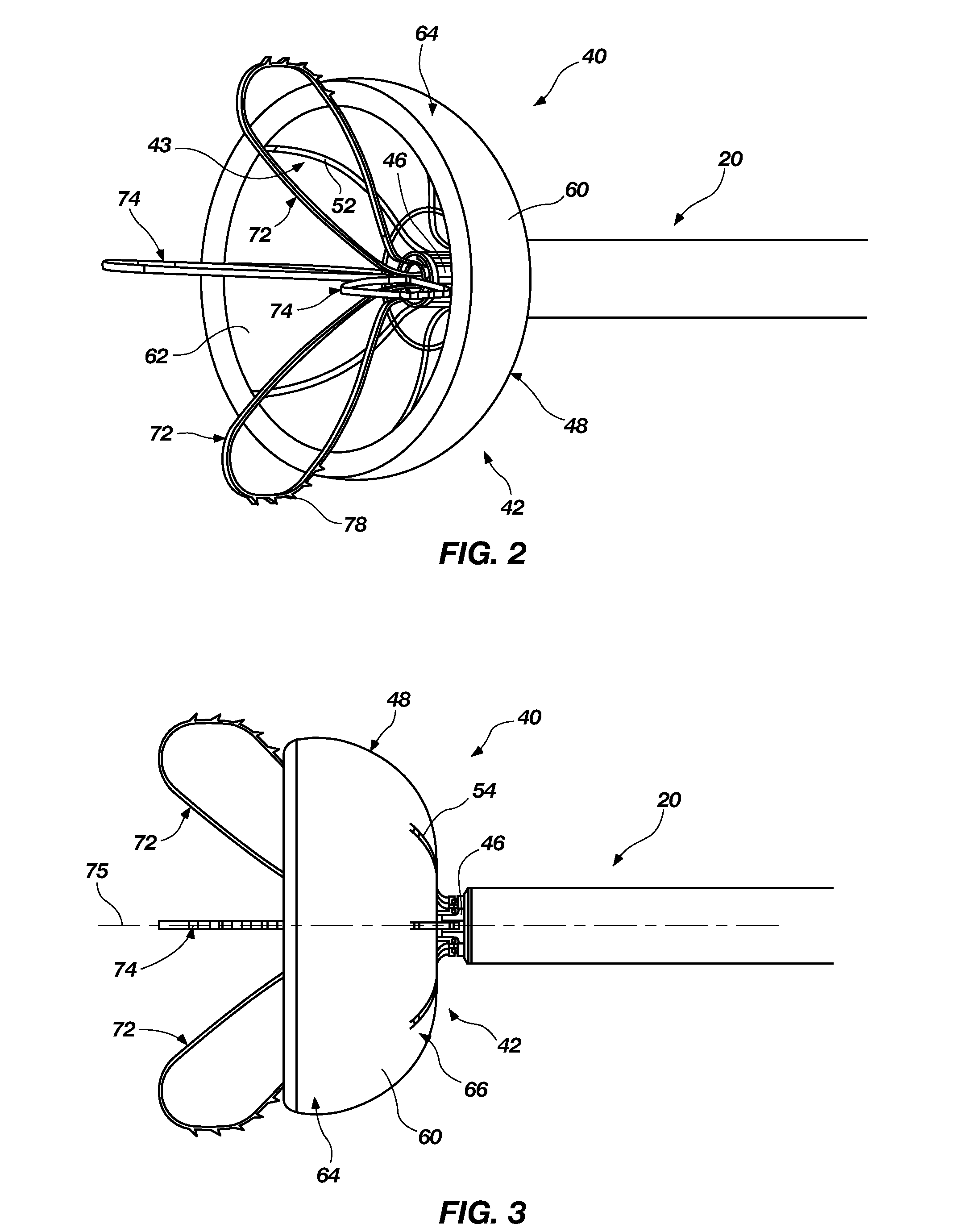 Medical Device and Delivery System for Modification of Left Atrial Appendage and Methods Thereof