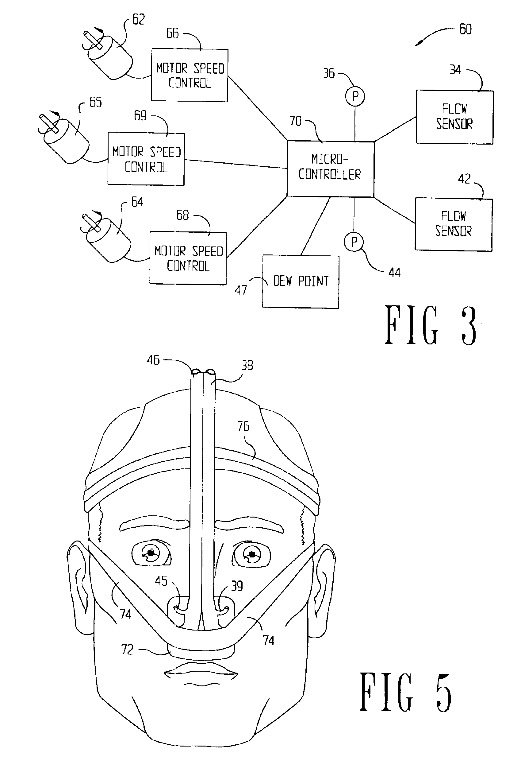 Method and system of individually controlling airway pressure of a patient's nares