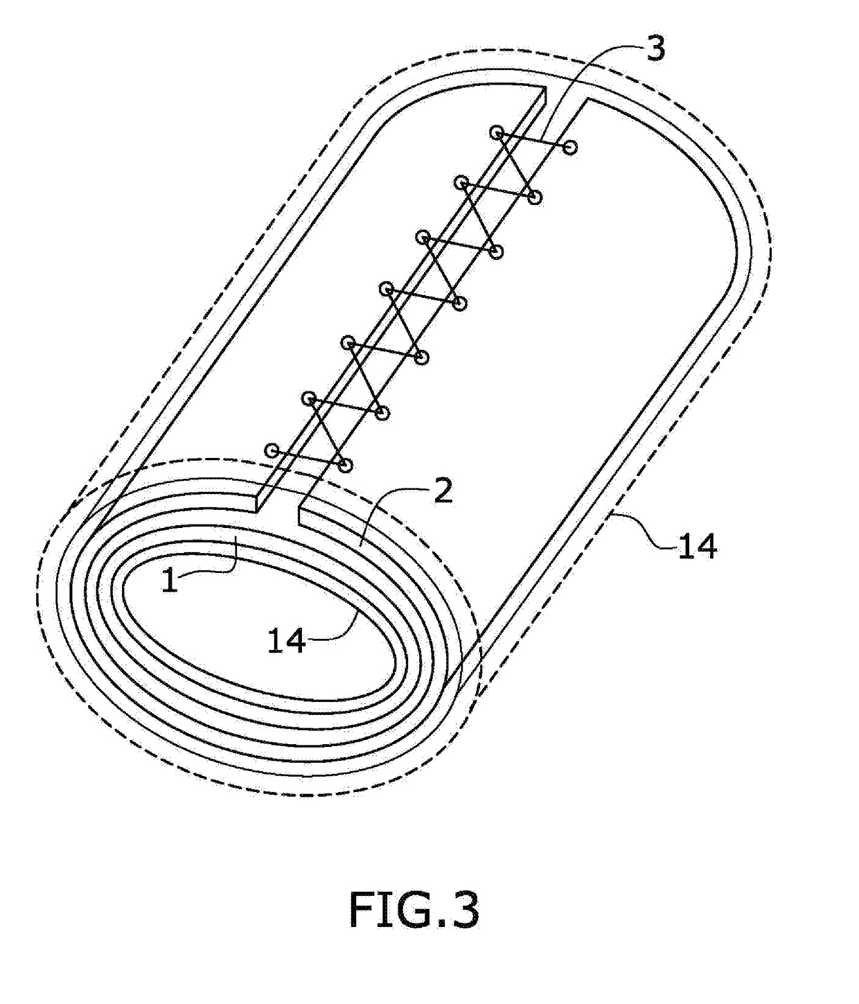 Device for treating arthritis and osteoarthritis in extremities and chronic inflammations and for reducing muscular pain and tension