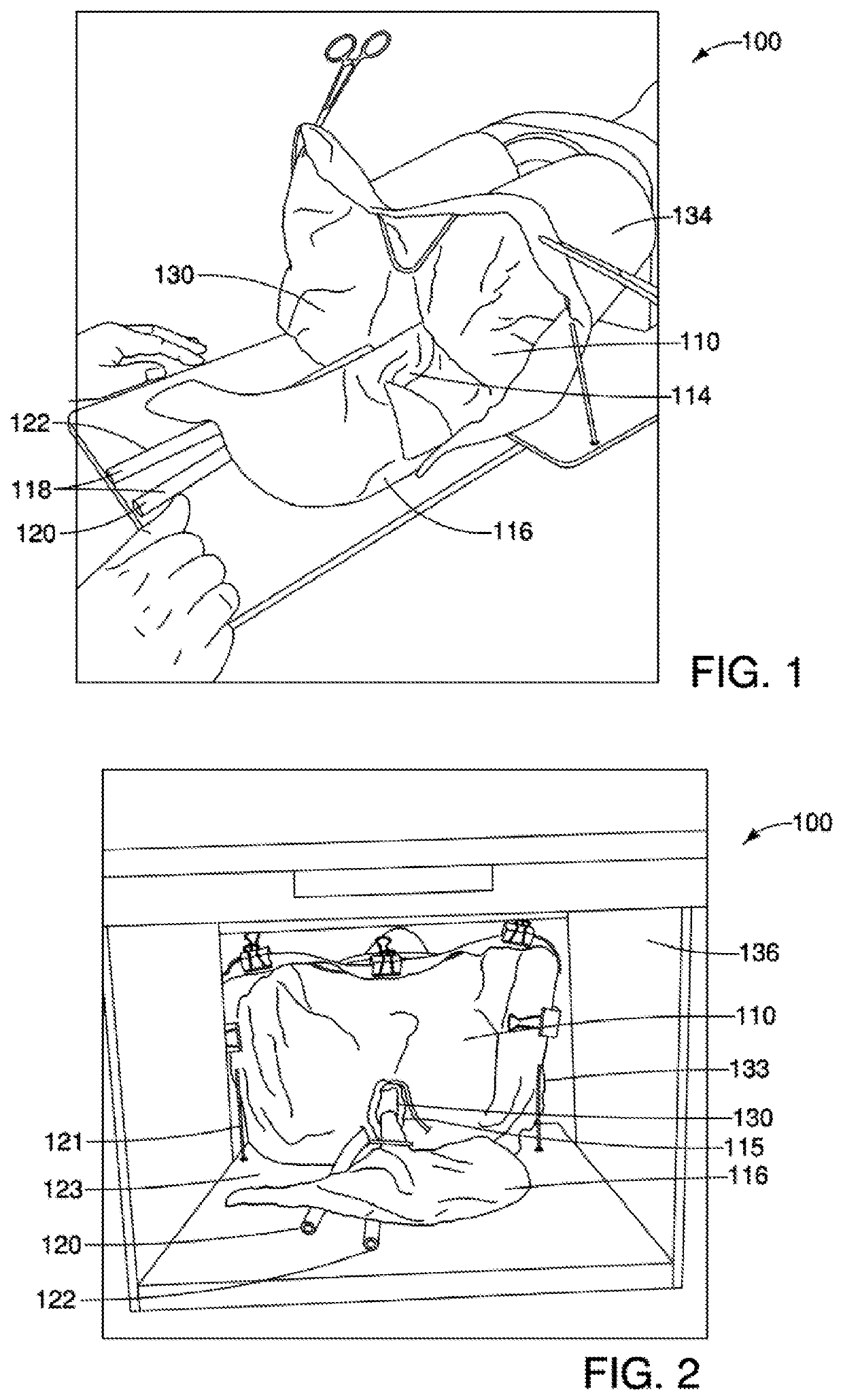 Inanimate model for laparoscopic repair