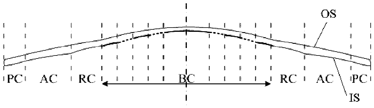 Corneal shaping lens