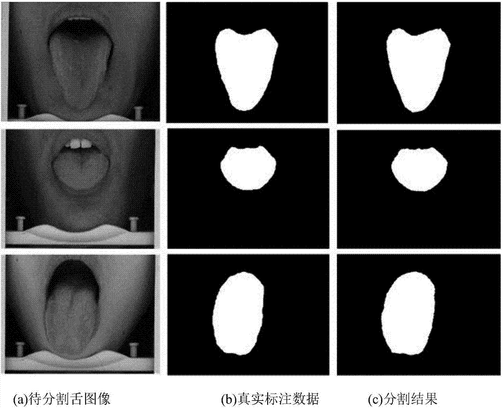 Deep convolutional neural network-based traditional Chinese medicine tongue image automatic segmentation method