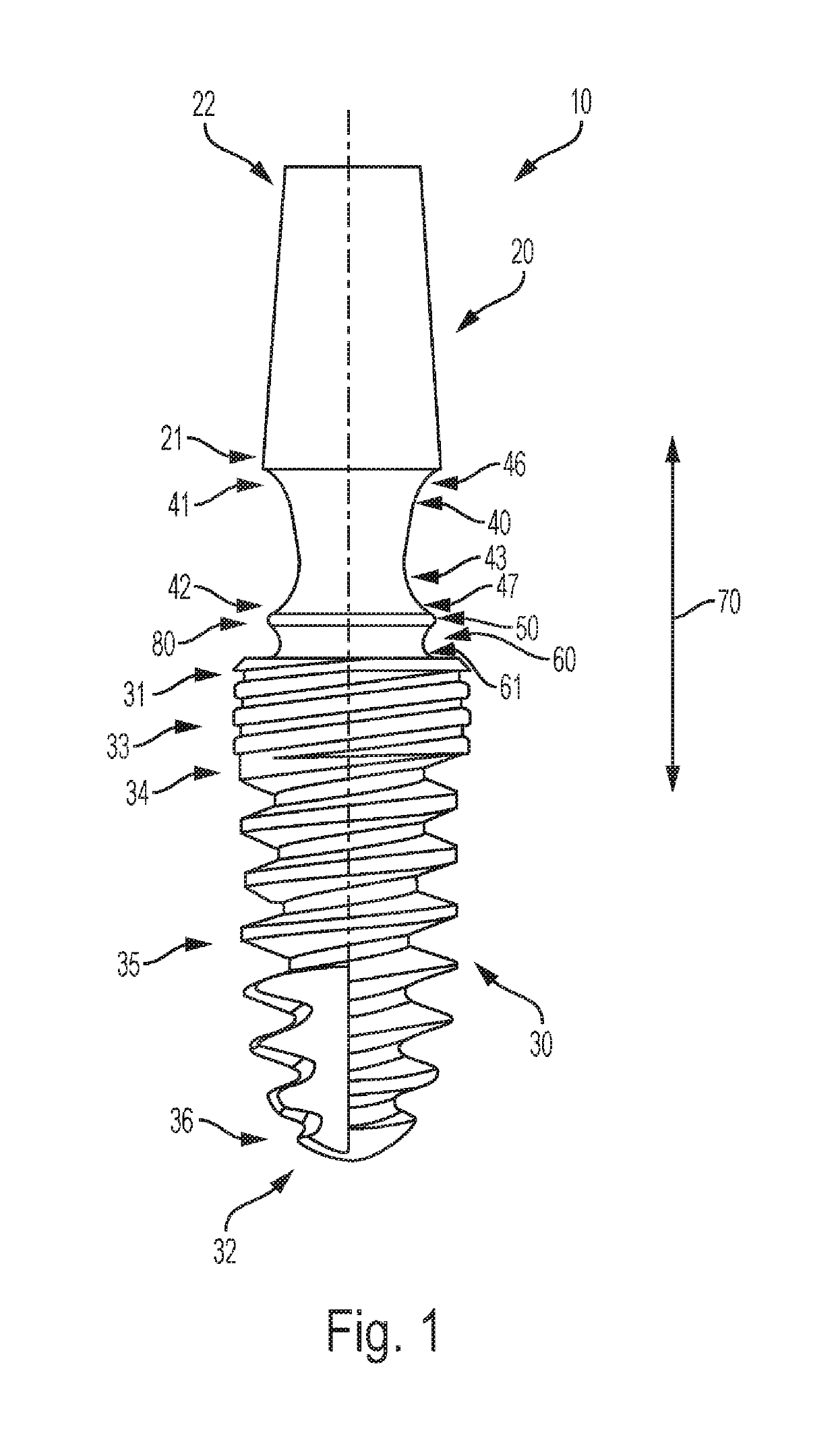 One-part tooth implant, device for bending an implant, and method for bending an implant