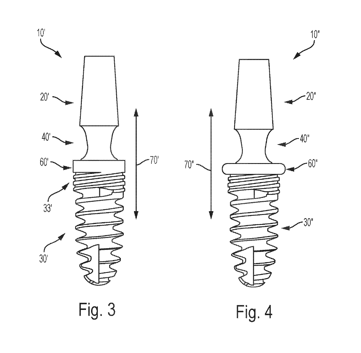 One-part tooth implant, device for bending an implant, and method for bending an implant