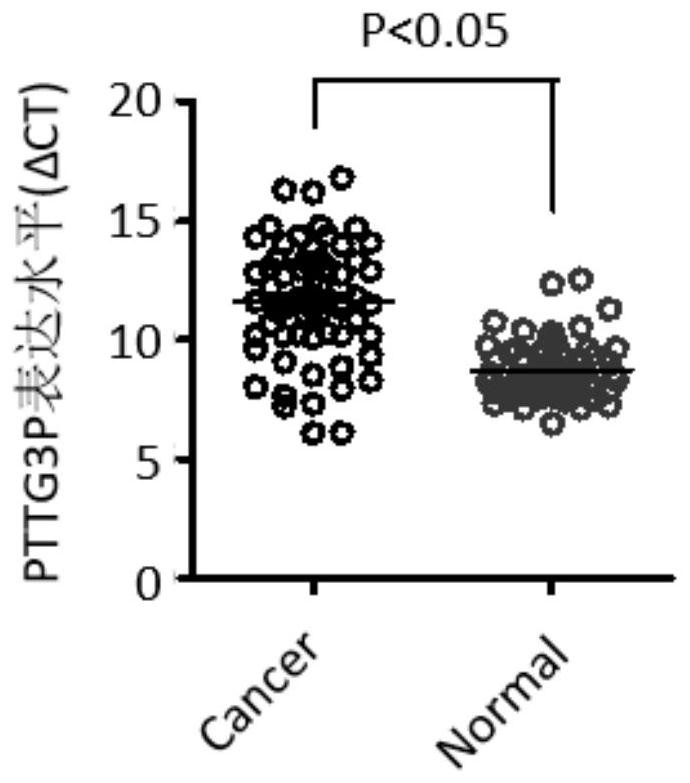 Application of pttg3p in preparation of pancreatic cancer diagnostic reagent or kit