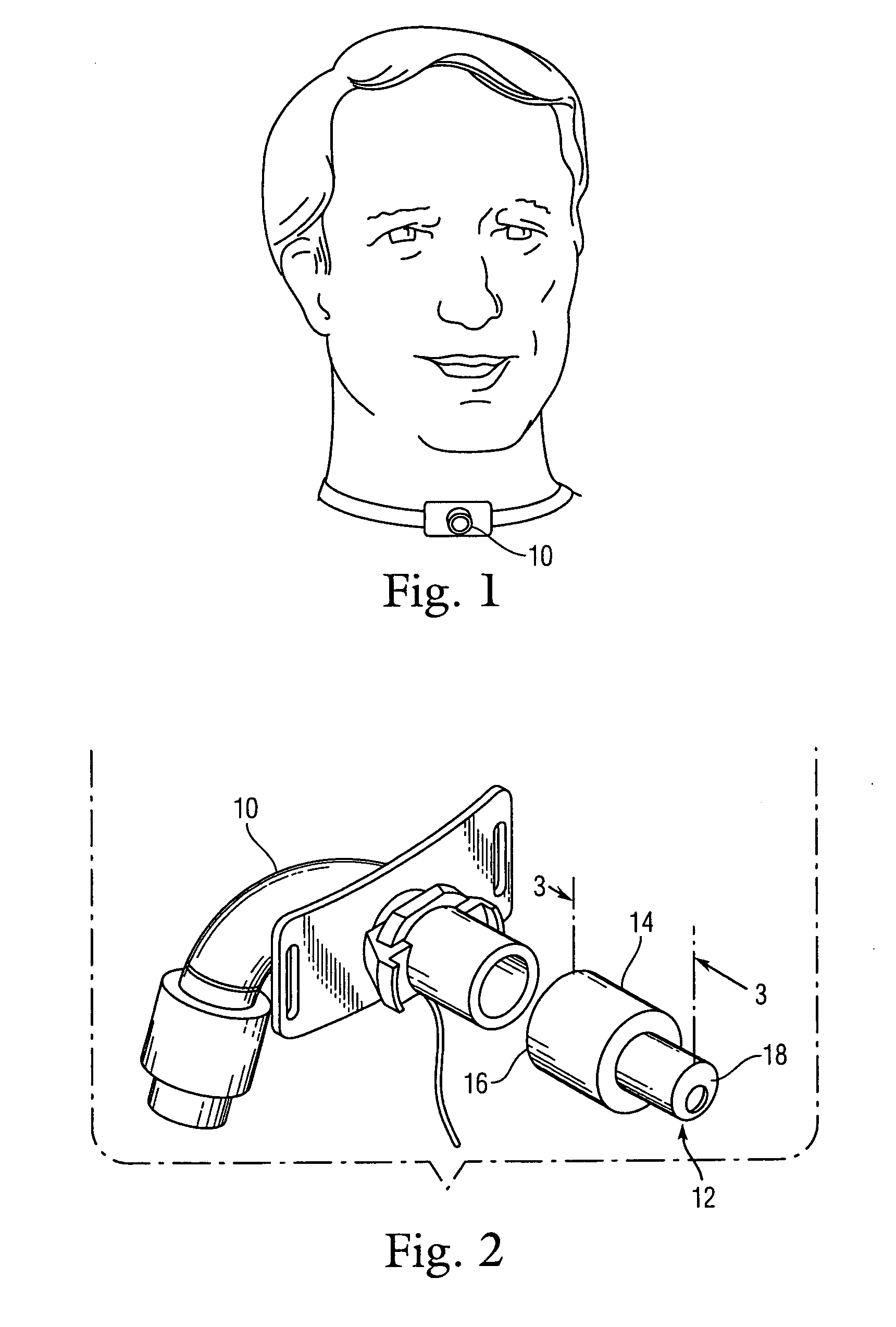 Multidirectional tracheotomy speaking valve