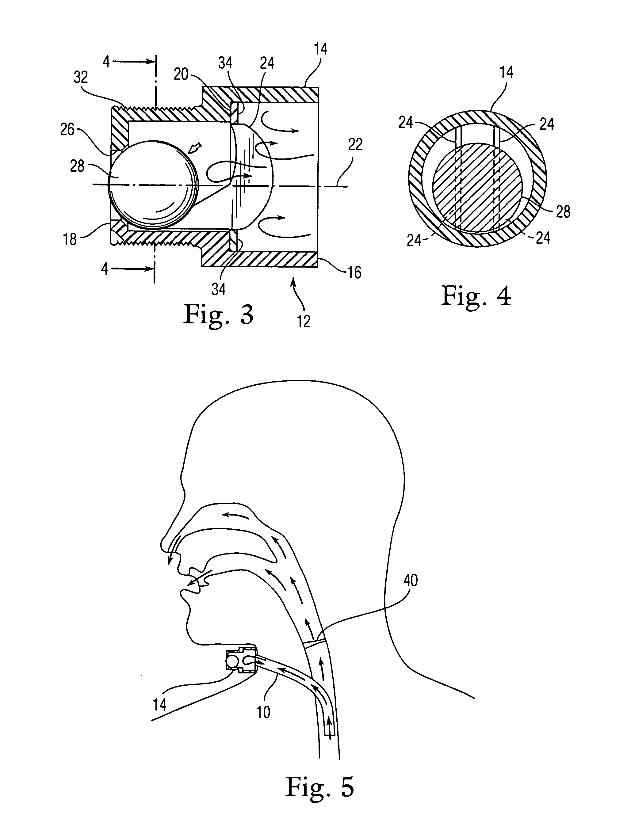 Multidirectional tracheotomy speaking valve